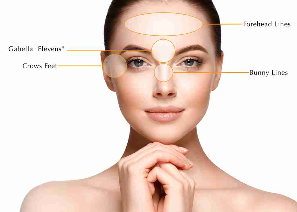 Botox Consultation