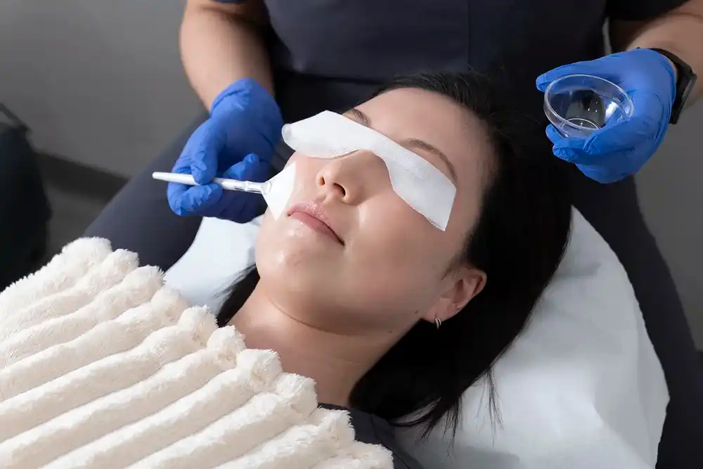 Chemical Peel Consultation
