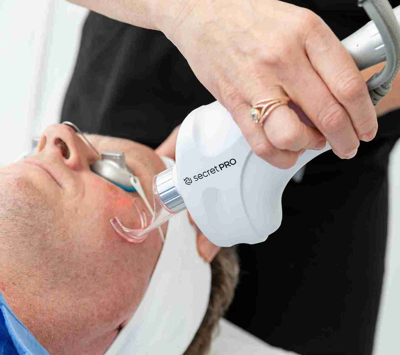 Laser Consultation