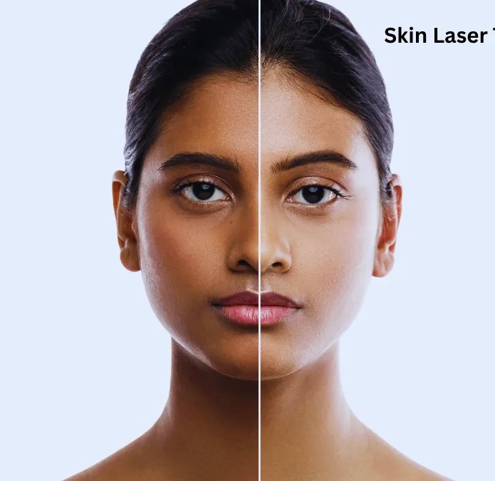Laser Skin Procedure