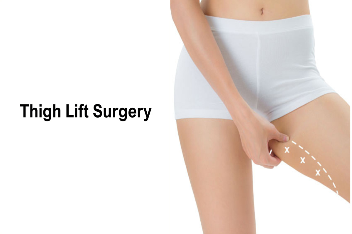 Thigh Lift Surgery