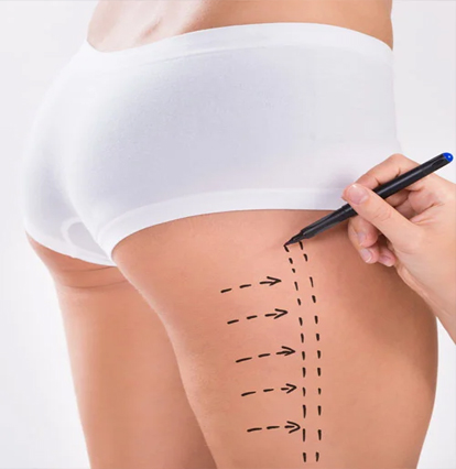 Consultation & Assessment